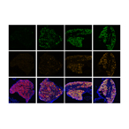 Neurons show increase in genetic activity over time (left to right) with larger and brighter areas of fluorescent colors