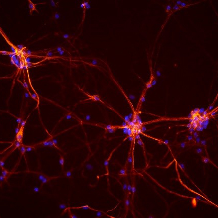 Mouse neurons 