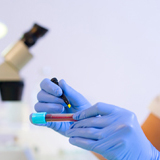 Researcher marking a test tube containing a blood sample in a medical laboratory, with a microscope in the background and other test tubes in the foreground.