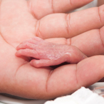 An adult's hand holding a preterm infant’s hand.