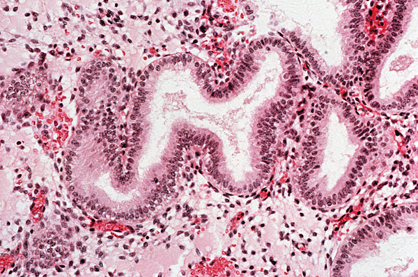 Microscopic view of the endometrium