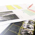 Printed copies of bone scan images on a desk top.