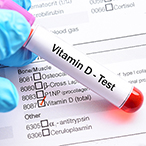 A gloved hand holds a test tube marked “Vitamin D Test,” in front of a check list of medical tests, with the box for “Vitamin D Test” checked.