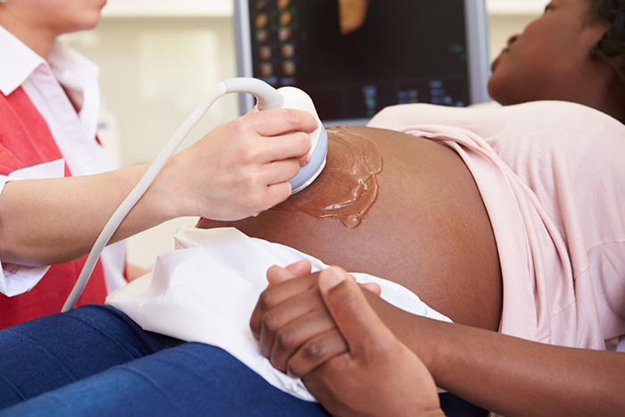 Pregnant woman getting ultrasound.