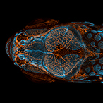 Dorsal view of bones, scales, and lymphatic vessels in a juvenile zebrafish.