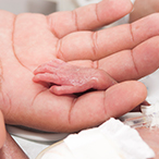 An adult’s hand holding the hand of a premature baby lying in an incubator.