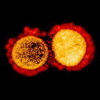 Colorized transmission electron micrograph of SARS-CoV-2 particles isolated from a patient.