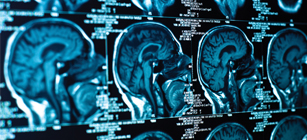 National Center for Medical Rehabilitation Research (NCMRR)