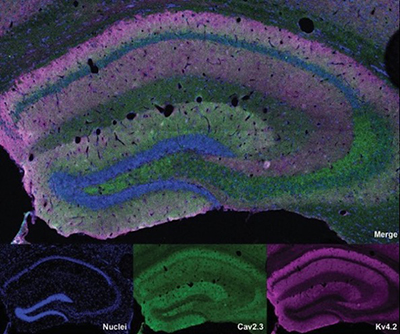 The top image shows the brain section with merged staining. The bottom row contains three images with separate stains for (from left to right) nuclei, Cav2.3, and Kv4.2.