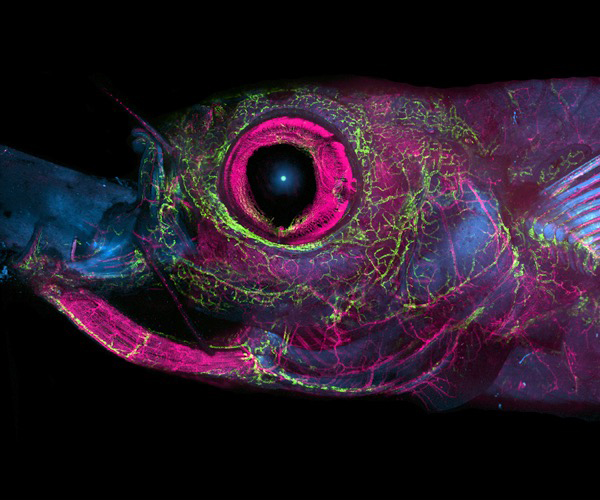 The image is zoomed in on the zebrafish head, with the eye (pink) and various vessel (green) visible against a black background.