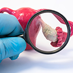 Gloved hand holding a magnifying glass to examine a plastic model of an ovary.