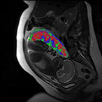 A cross-section of the pregnant person and fetus are visible in black and white. The placenta is shown at the top of the uterus in red, green, and blue.