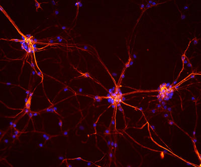 Red- and blue-colored cells branch out against a black background