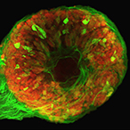 A donut-shaped mass of red cells is dotted with green against a black background. The green fibers are bunched along the lower left edge.