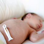 Shirtless newborn with clamped remnant umbilical cord visible.