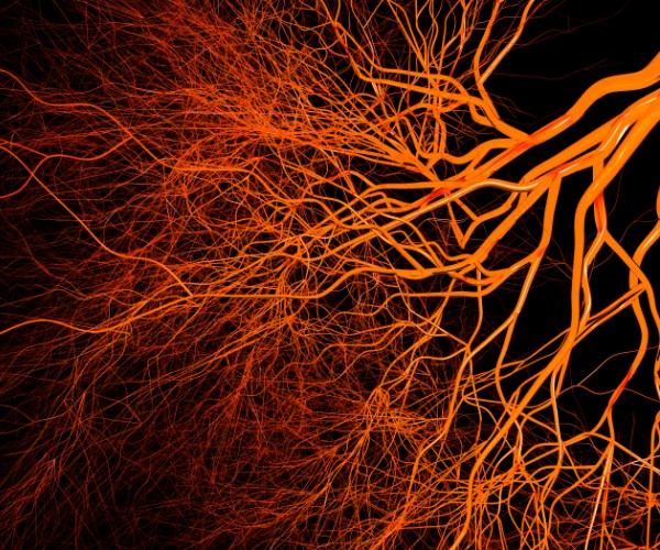 A fibrous mass of orange-red hair-like vessels against a black background branch from the top right corner to the bottom left corner.