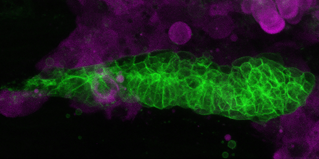 Microscopy image showing a cluster of green cells against a backdrop of purple cells.