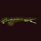 Zebrafish with fluorescently labeled lymphatic and blood vessels and vascular malformation in the tail.