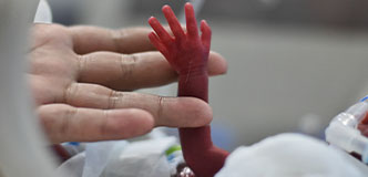 Adult hand holding tiny preterm infant hand.