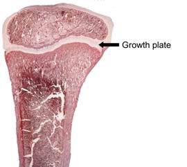 Cross section of a rabbit bone showing the growth plate