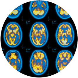 Brain scans