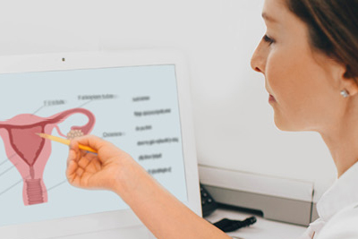 A healthcare provider consults a medical illustration of the female reproductive system on the provider’s computer screen.